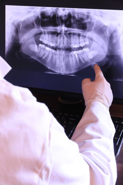 Best Emergency Treatment for Toothache in Carpentersvle, IL