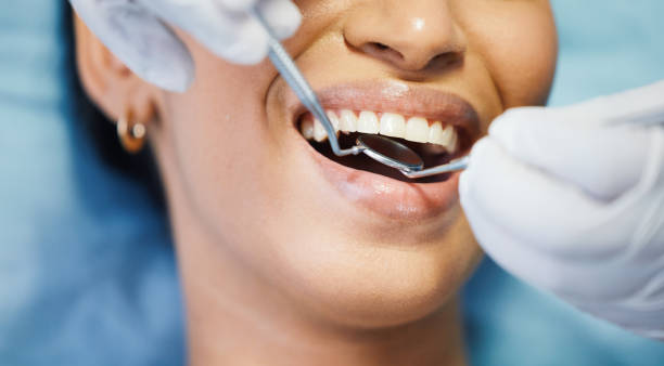 Best Emergency Broken Tooth Repair in Carpentersvle, IL