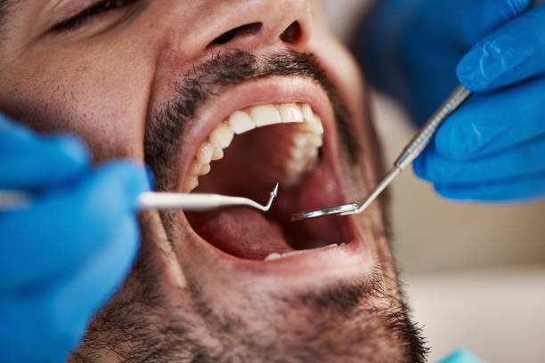 Best Pediatric Emergency Dentist in Carpentersvle, IL